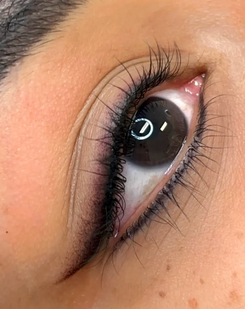 What Causes Tattoo Scabbing